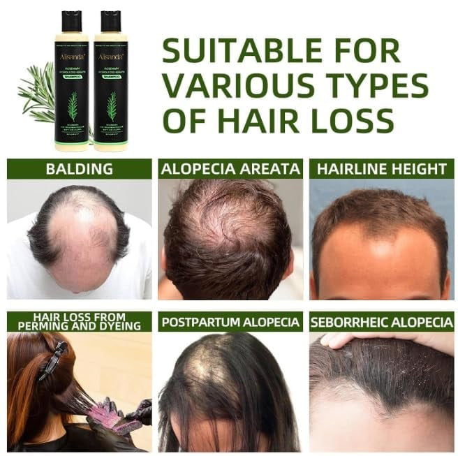 Alisanda® Organic Rosemary Hair Growth Shampoo